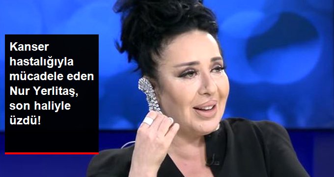 Modacı Nur Yerlitaş, Ameliyatlar Sonrası Son Haliyle Takipçilerini Üzdü!