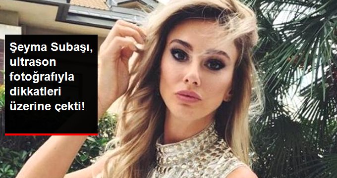 Şeyma Subaşı, Paylaştığı Ultrason Fotoğrafıyla Dikkatleri Üzerine Çekmeyi Başardı!