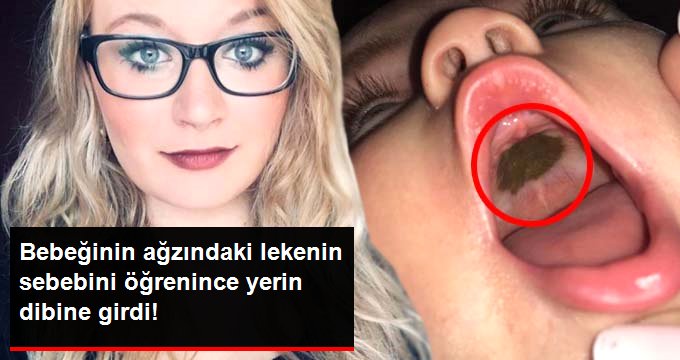 Bebeğinin ağzındaki lekenin sebebini öğrenince şaşkına döndü!