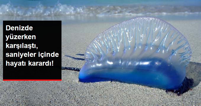 Denizin en ölümcül canlısı, genç kadının hayatını kararttı!