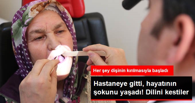 Kırılan dişinden sonra kansere yakalanan kadının dilinin yarısı kesildi!