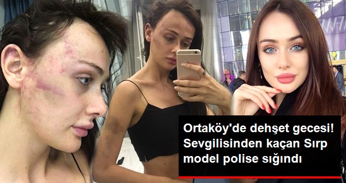 Ortaköy’de dehşeti yaşayan Sırp model, sevgilisinden kaçıp polise sığındı!