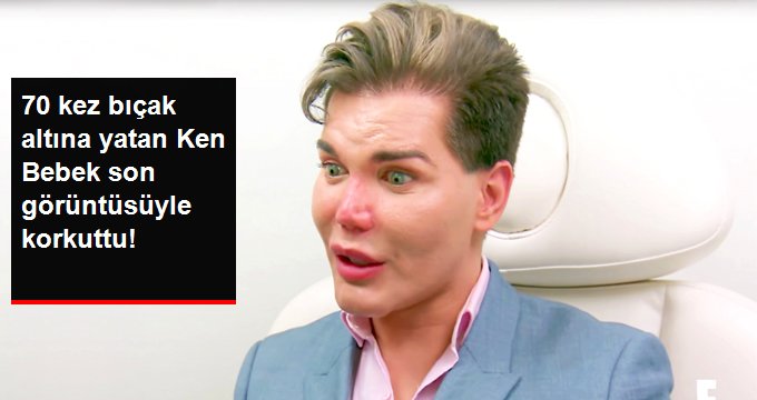 70. kez bıçak altına yattı! Estetik bağımlısı Ken Bebek’in son hali korkuttu