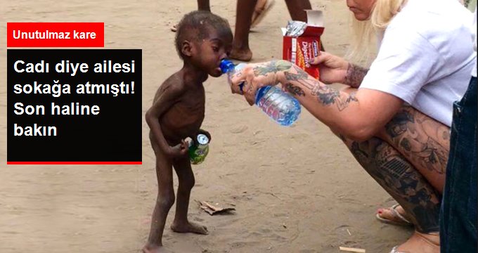 ‘Cadı’ diye ailesi tarafından sokağa atılmıştı, bakın şimdi nasıl gözüküyor!