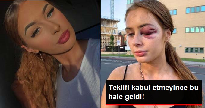 İngiltere’de bir genç kız, ‘birlikte eğlenme’ teklifini kabul etmediği kişi tarafından darp edildi